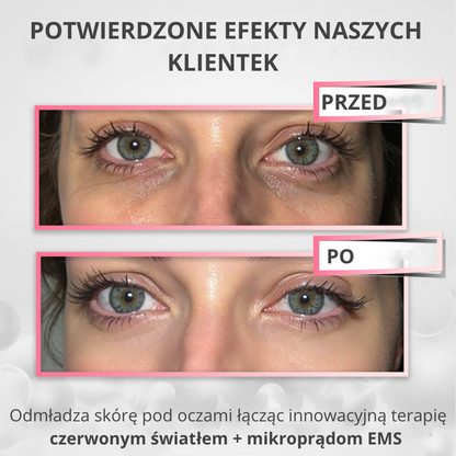 Queme - Okulary Do Terapii Światłem
